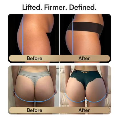 PRIZELTA CURVIFY EMS Toning Shorts